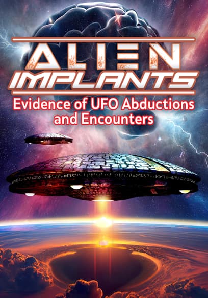 Alien Implants: Evidence of UFO Abductions and Encounters