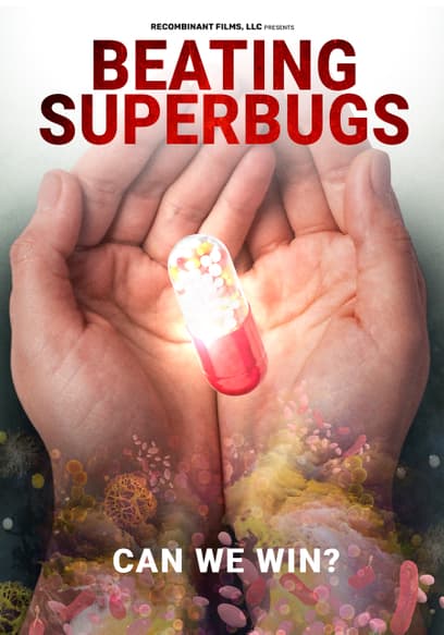 Beating Superbugs: Can We Win?