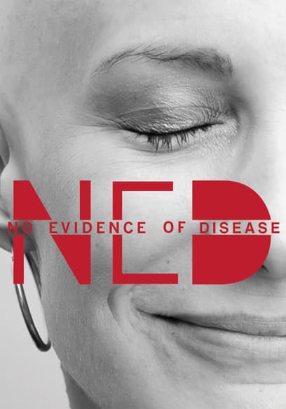 No Evidence of Disease