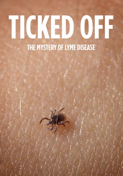 Ticked Off: The Mystery of Lyme Disease