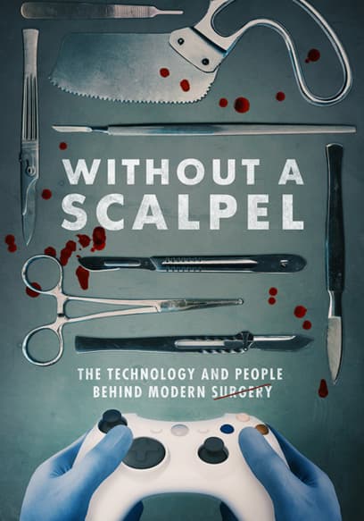 Without a Scalpel