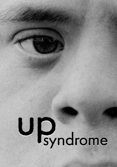 Up Syndrome