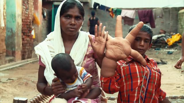 S01:E03 - The Boy With the World's Biggest Hands